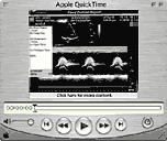 Quick Time